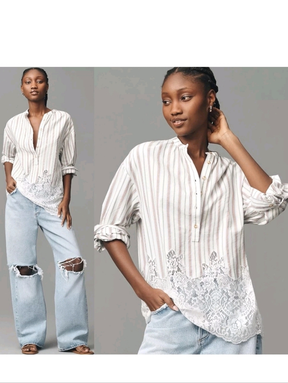 Pilcro Stripe Lace Button Down Tunic Top XL Preppy Boho Casual NWT Anthropologie